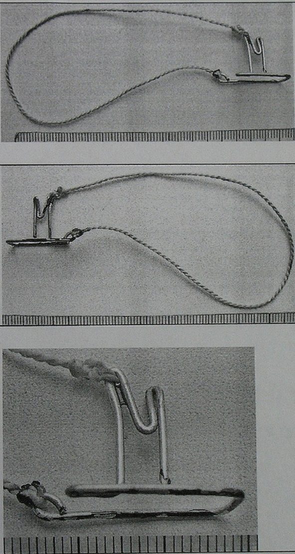 Ливансакя петля