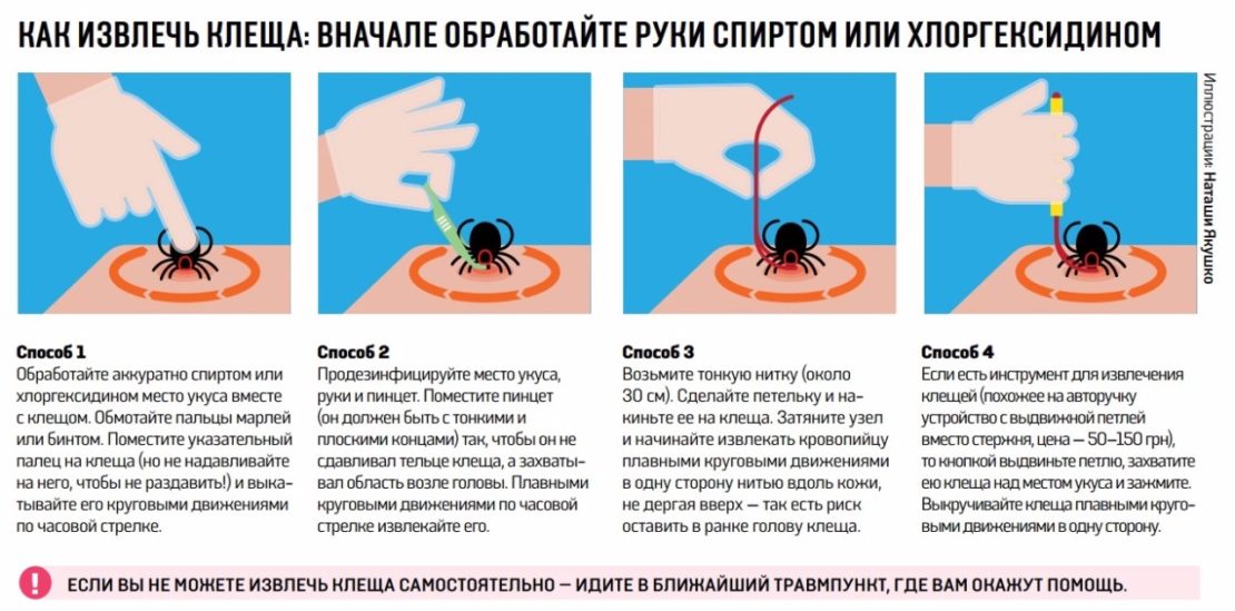 Особенности извлечения присосавшегося клеща